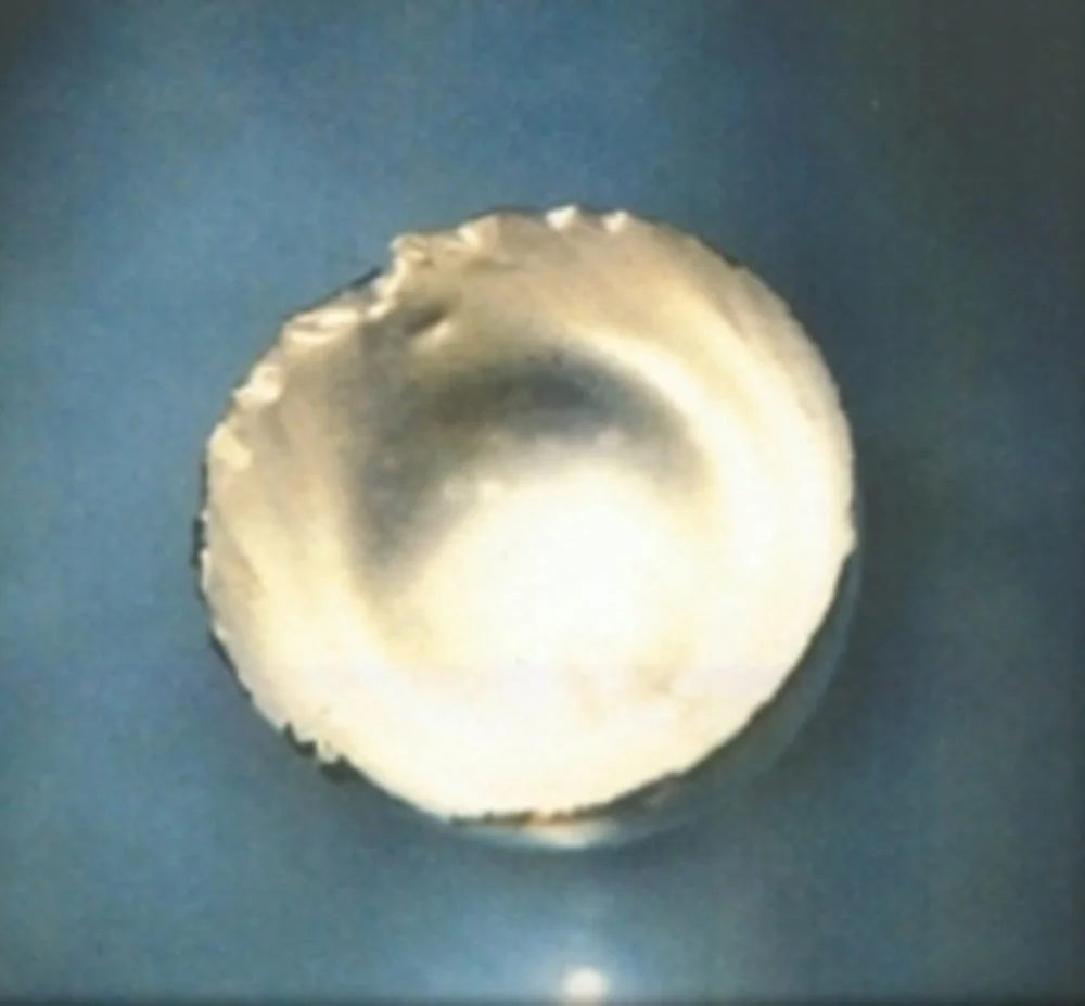 Fermium adalah