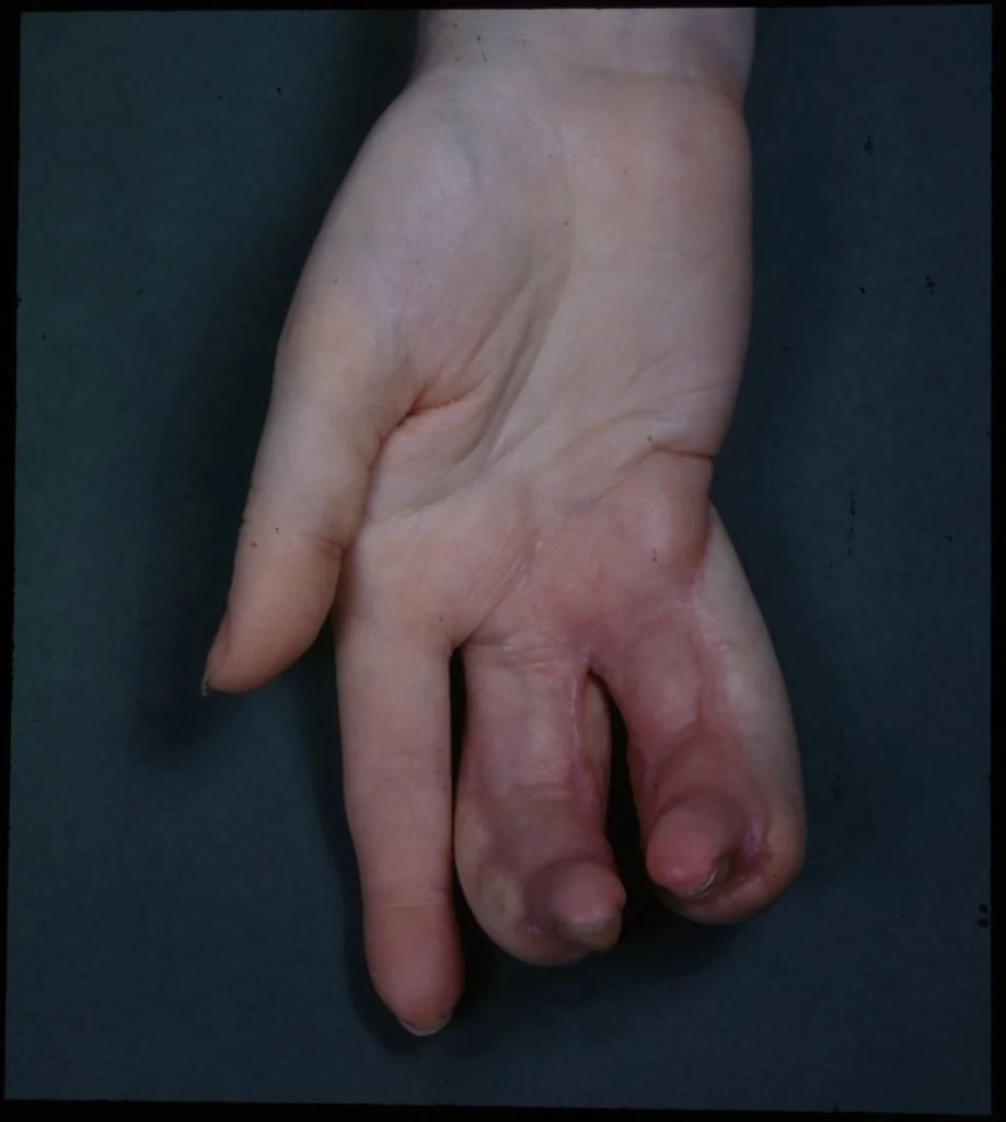 Sinar X ray