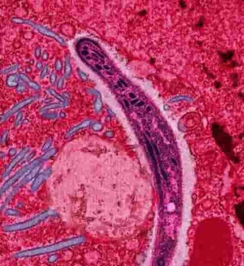 Plasmodium dari air ludah nyamuk