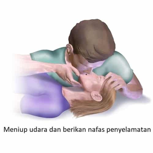 CPR Meniup udara dan berikan nafas penyelamatan