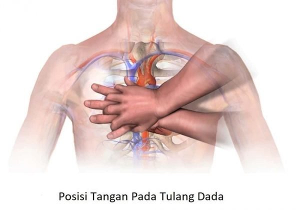 Cara Melakukan CPR - Resusitasi Jantung Paru Untuk Dewasa Anak Bayi