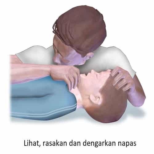CPR lihat rasakan dengarkan napas