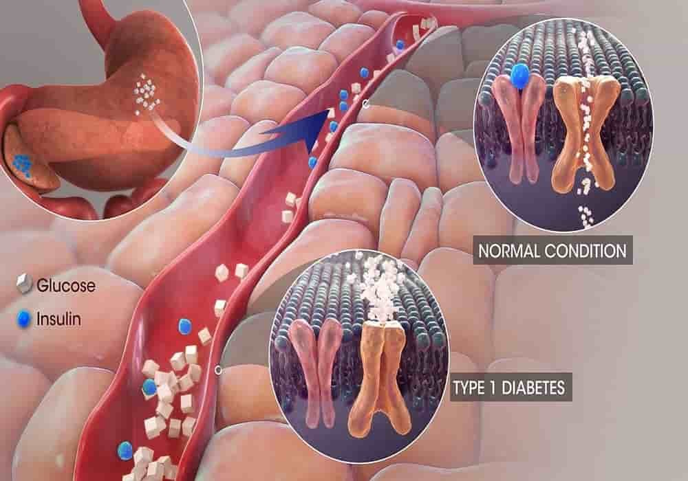 Pertolongan Pertama Kedaruratan diabetes