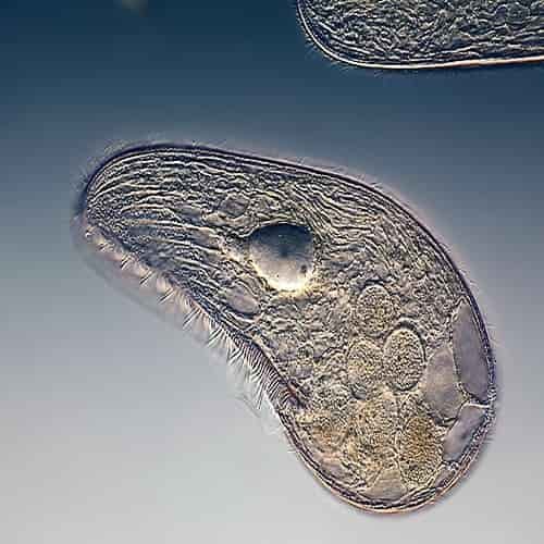 Protozoa mikrofoto blepharisma
