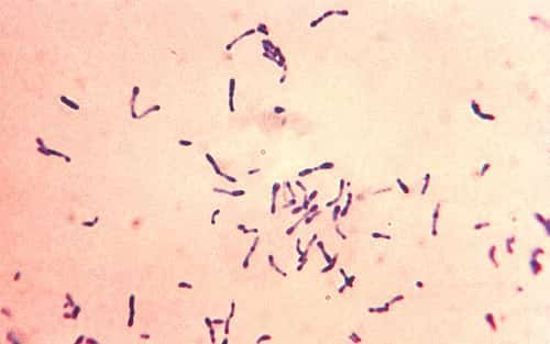 bakteri Gram positif Corynebacterium