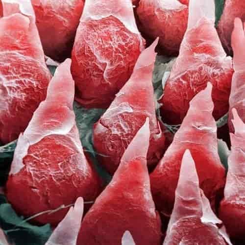 Permukaan lidah di bawah mikroskop