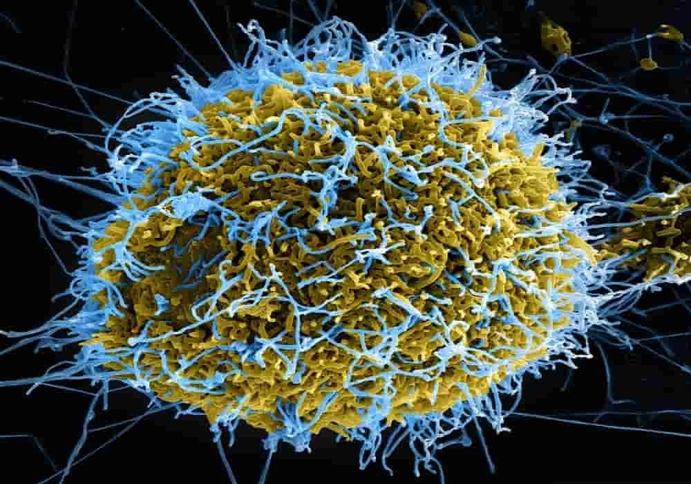 Virus ebola