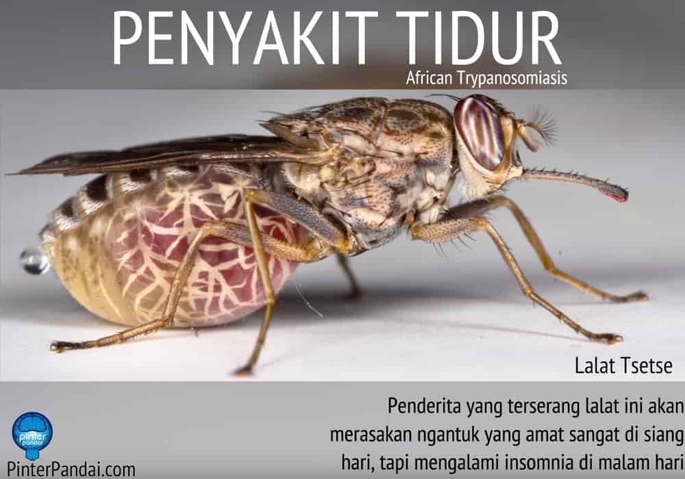 Penyakit Tidur - African Trypanosomiasis - Disebabkan Oleh Gigitan Lalat Tsetse - Penjelasan, Penyebab, Gejala dan Pengobatan