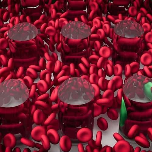 Kekurangan Zat Besi - Iron Deficiency Anemia - Penjelasan, Penyebab, Pengobatan