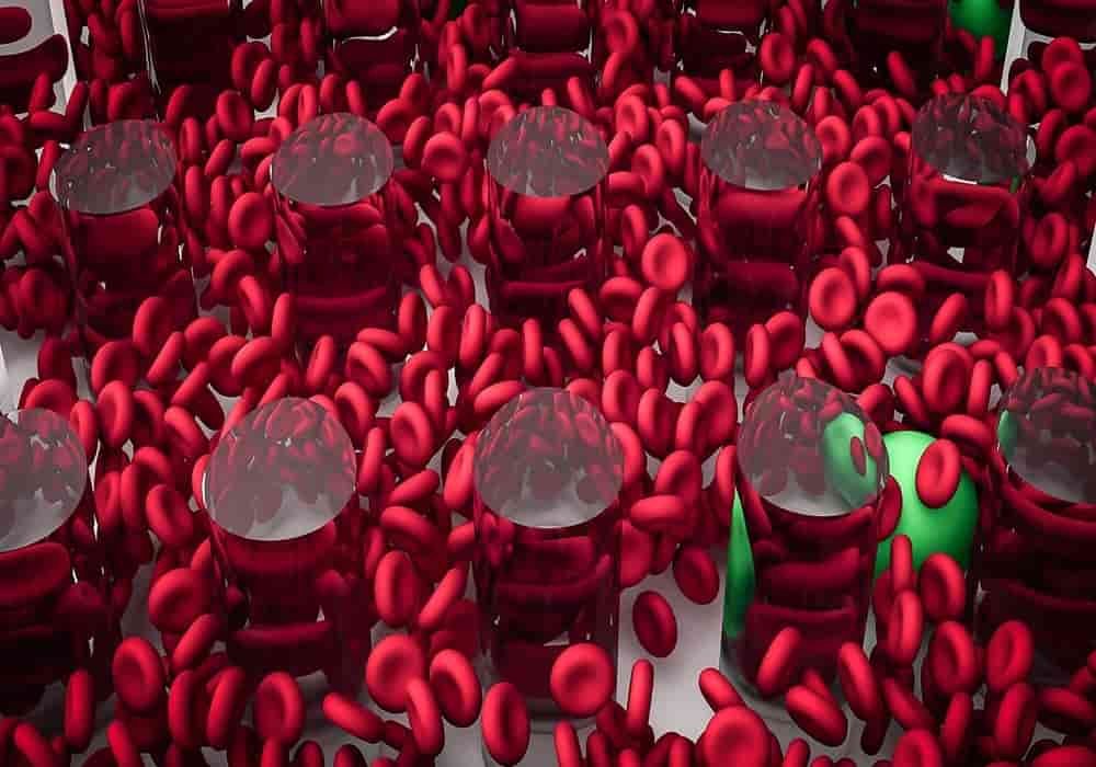 Kekurangan Zat Besi - Iron Deficiency Anemia - Penjelasan, Penyebab, Pengobatan