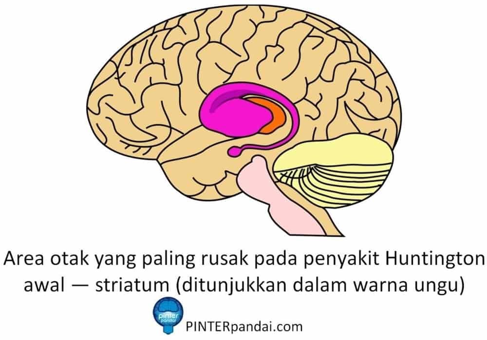 Area otak paling rusak penyakit huntington