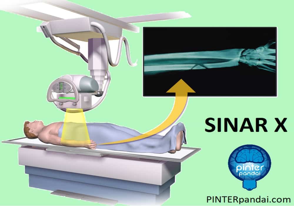 Sinar x ray