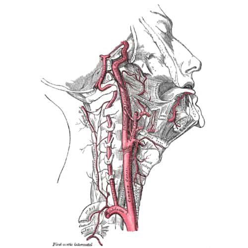 Sinus karotis karotid