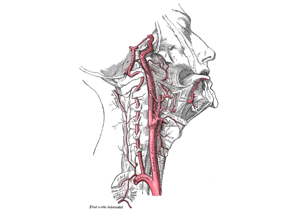 Sinus karotis karotid