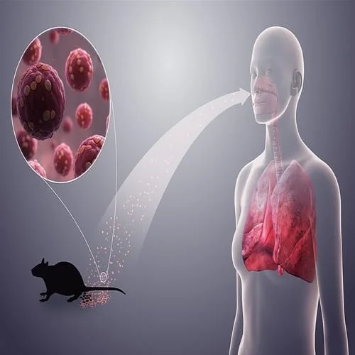 Penyakit hantavirus