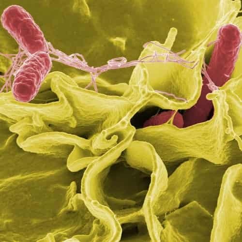 Salmonella typhimurium (merah) Daftar bakteri mikrobiota manusia