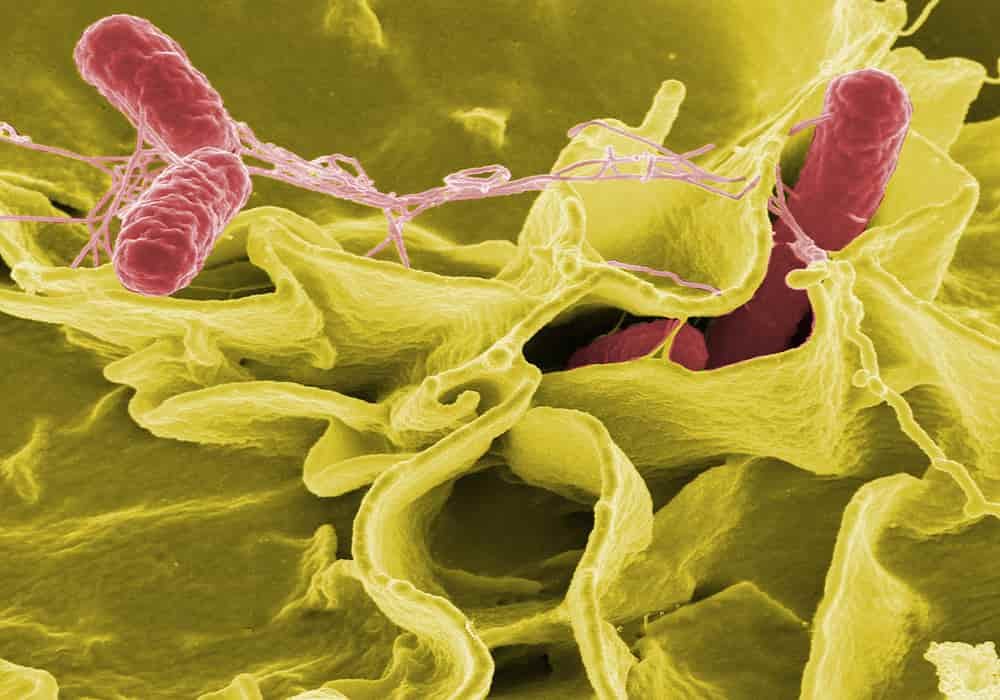 Salmonella typhimurium (merah) Daftar bakteri mikrobiota manusia