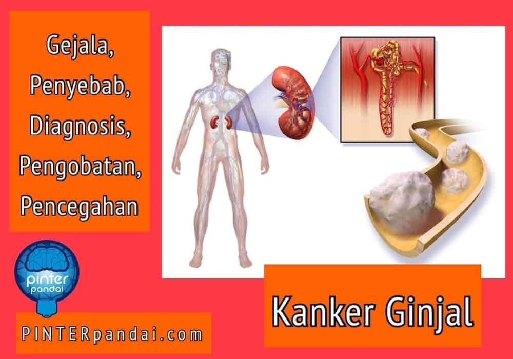 Penyakit kanker ginjal
