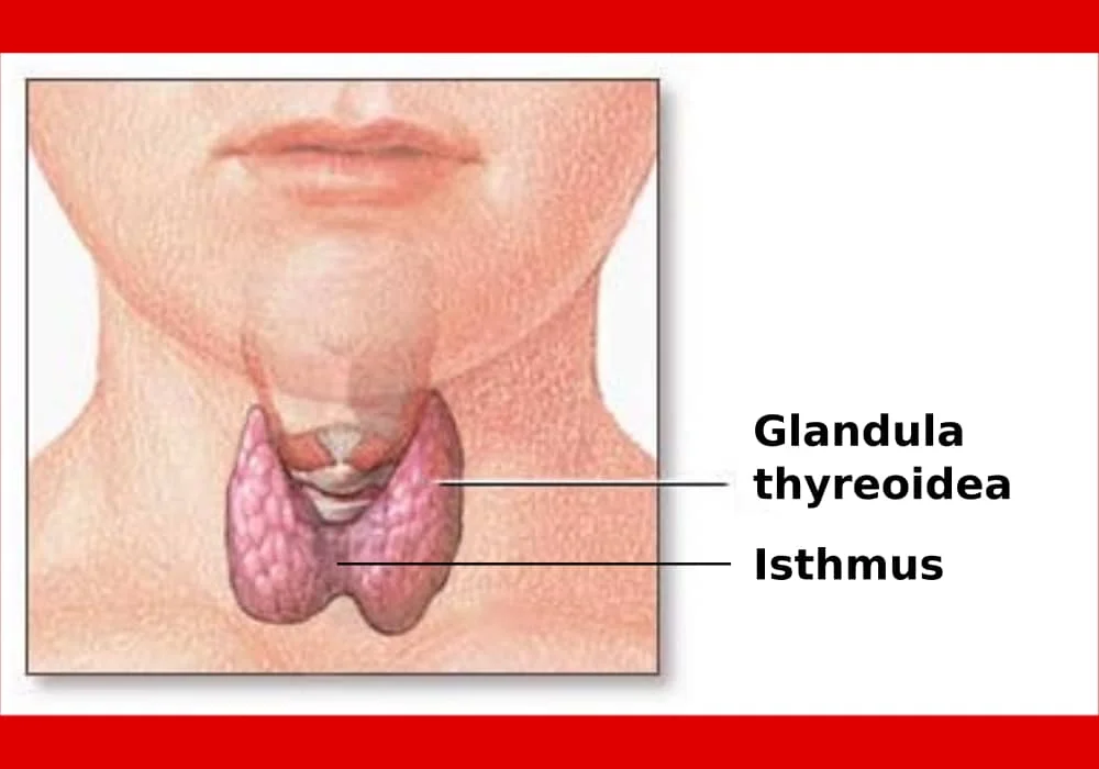 Tumor Tiroid - Kondisi Tiroid Non-Kanker. Gejala, Penyebab, Diagnosis, Pengobatan, Pencegahan