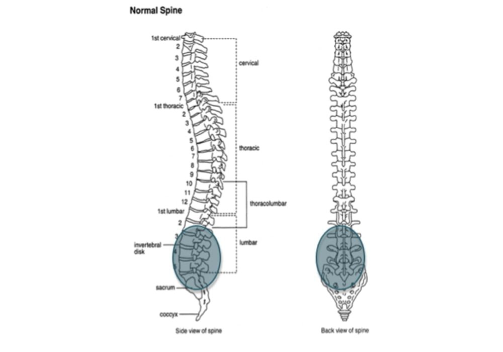 Area primer yang terkena ankylosing spondylitis