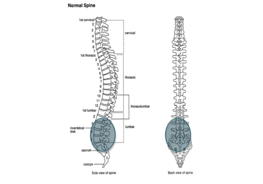Area primer yang terkena ankylosing spondylitis