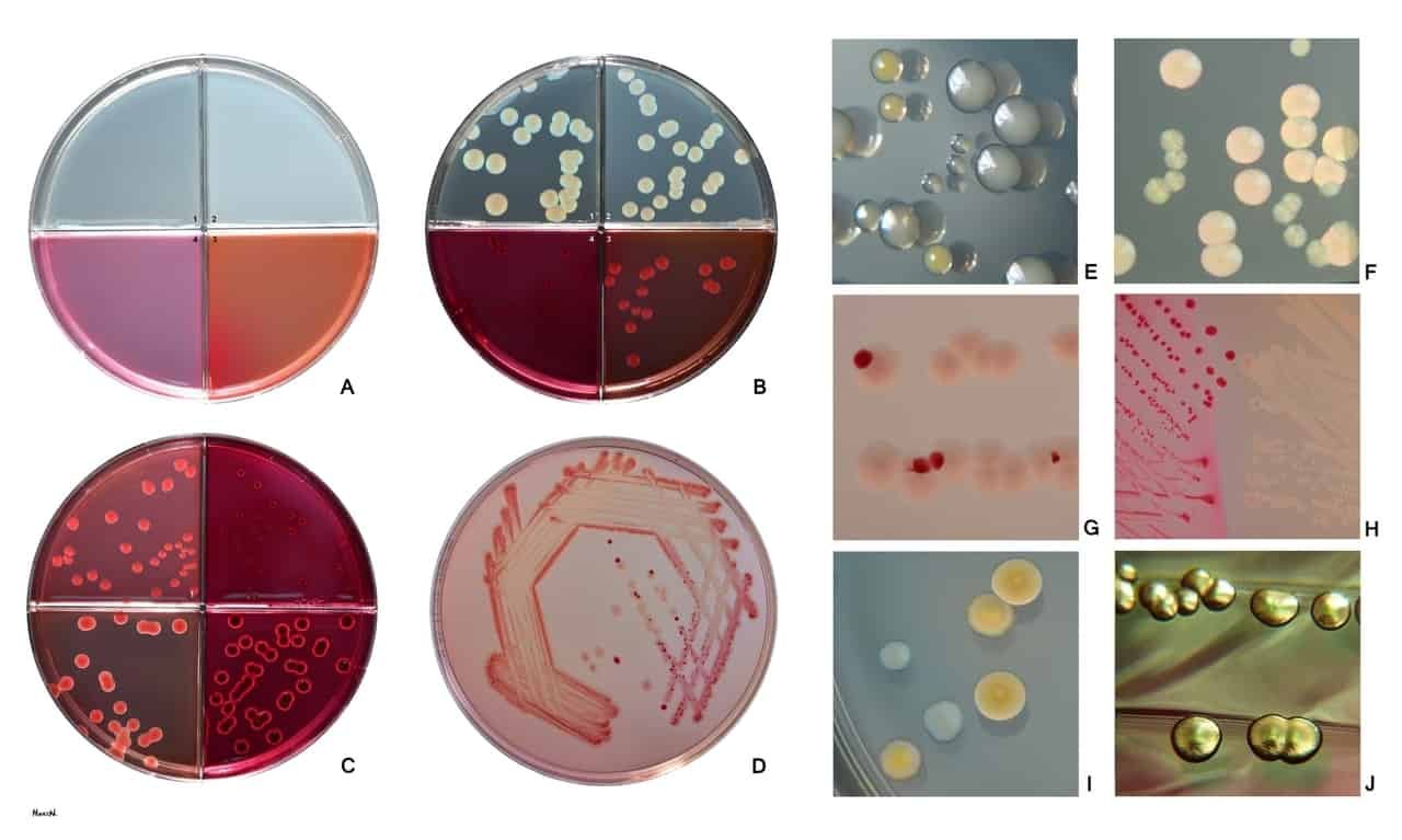 Escherichia coli (bakteri E Coli)