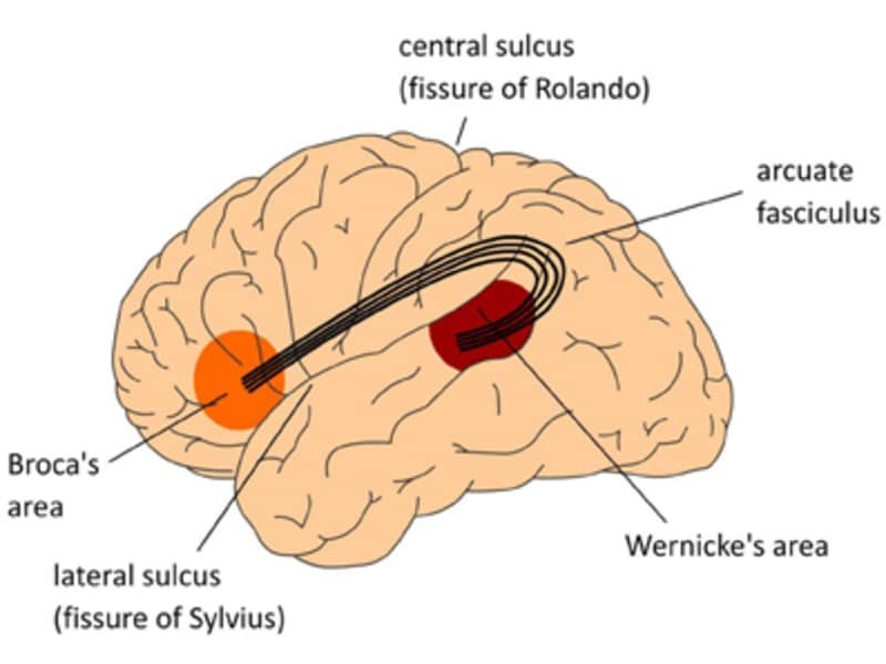 Broca wernicke afasia