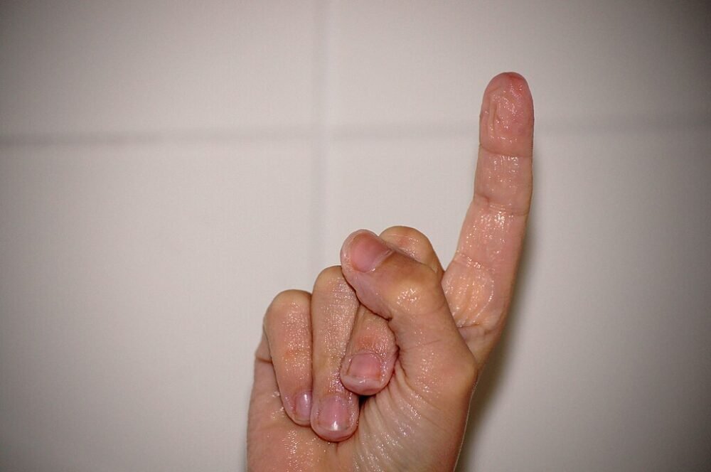 Kulit Berkerut di Air: Kenapa Hanya Terjadi di Tangan dan Kaki?